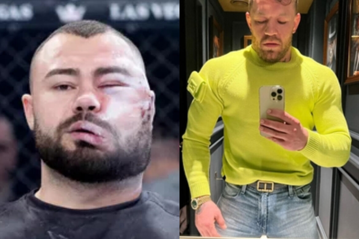 Conor McGregor, boodschap voor de Roemeen die zich voor 5.000 euro liet misvormen. Hoe Sorin Comșa, de kampioen van de mepwedstrijd, zich nu voelt…