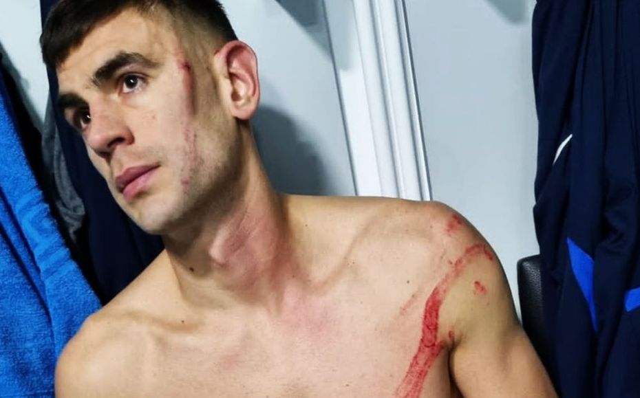 Edjouma, gruwelt van Igor Armaș: “Hij had me kunnen verminken!”. FCSB-speler ontsnapt aan uitschakeling